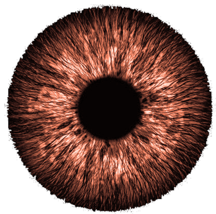 pupille de couleur orangée